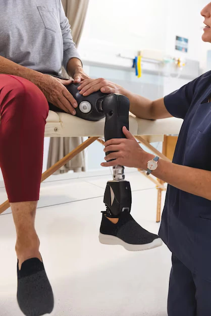 caucasian female physiotherapist senior woman with artificial leg stretching hospital 13339 335500